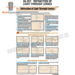 CHARTS-ZOOLOGY-SCIENCE (Refraction of Light Through Lenses) (MFCH-9)